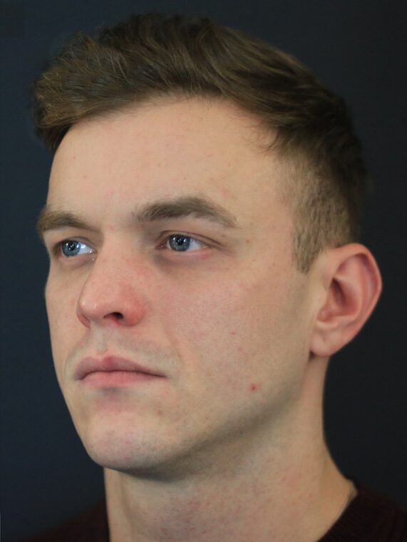 Chin Jawline man Chin Jawline man