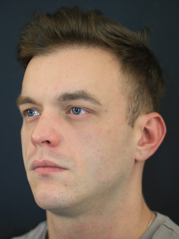 Chin Jawline man Chin Jawline man