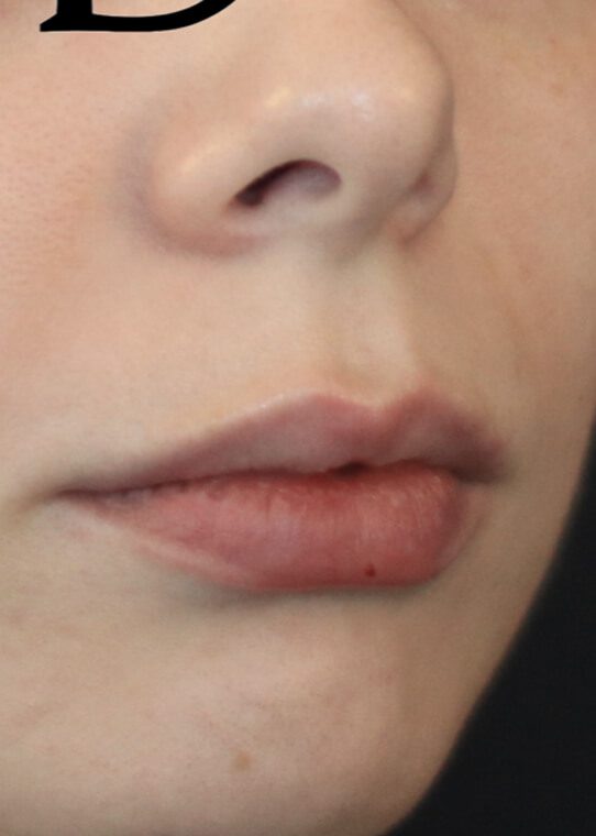 womans health ageing well lips example 2