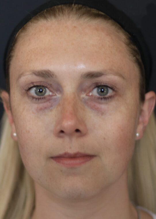 womans health ageing well mid face example 3 womans health ageing well mid face example 3