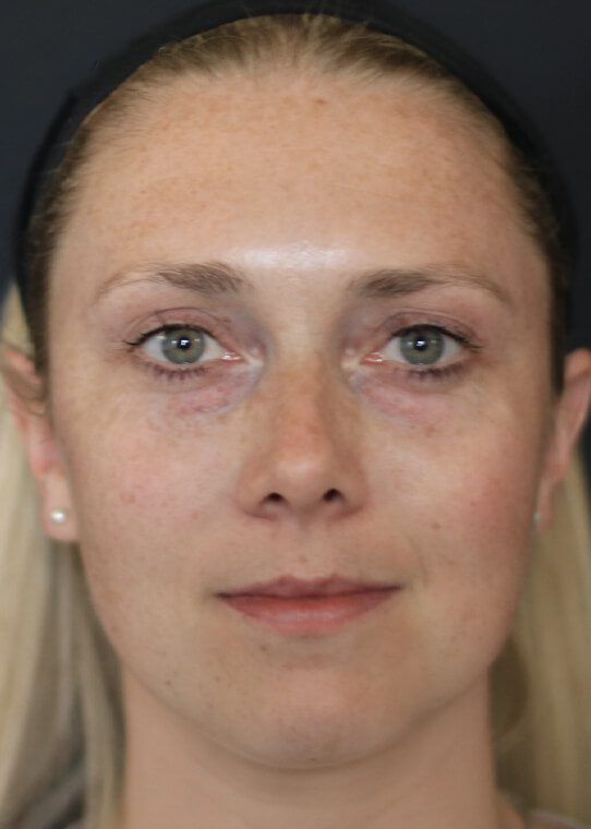womans health ageing well mid face example 3 womans health ageing well mid face example 3