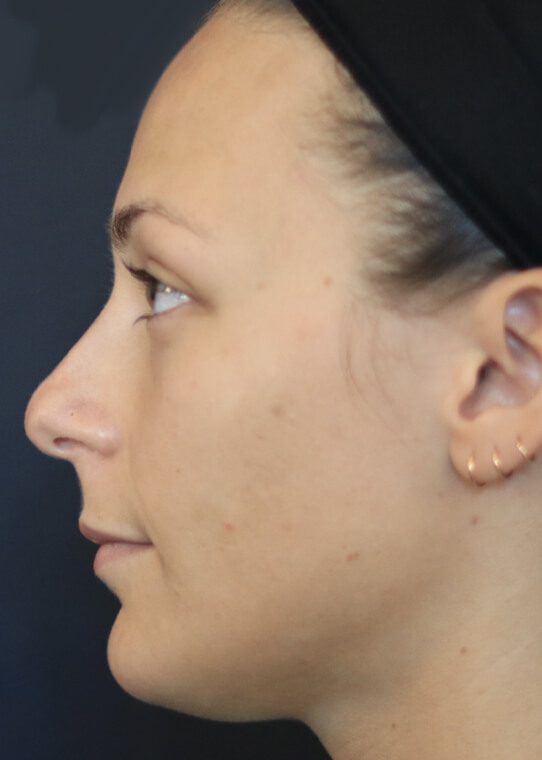 aesthetically pleasing to the eye and completing a lovely natural profile to a face.