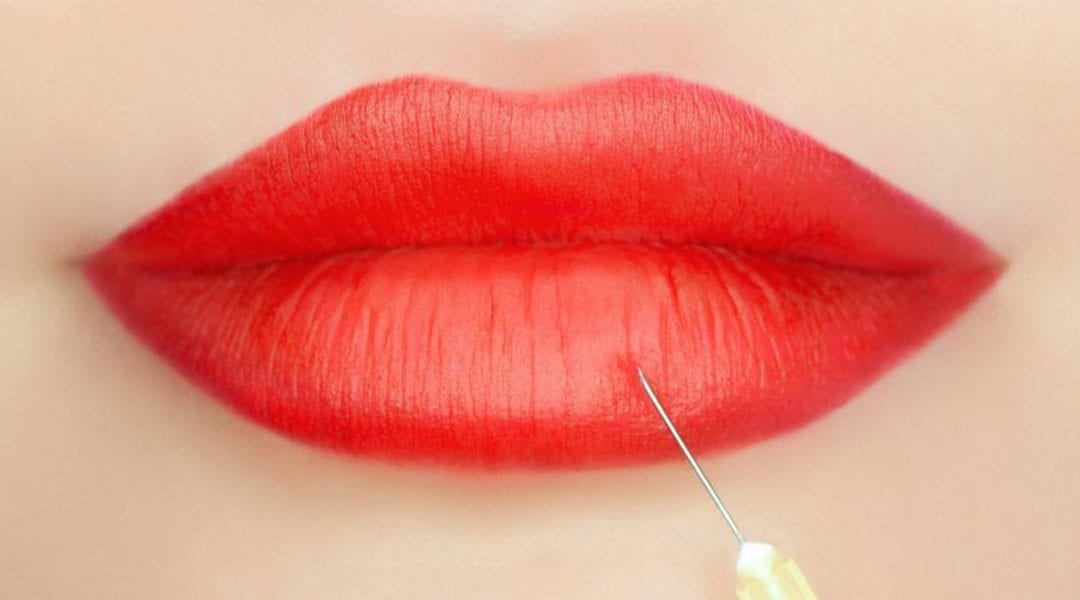 Why lip injections are better than lip implants