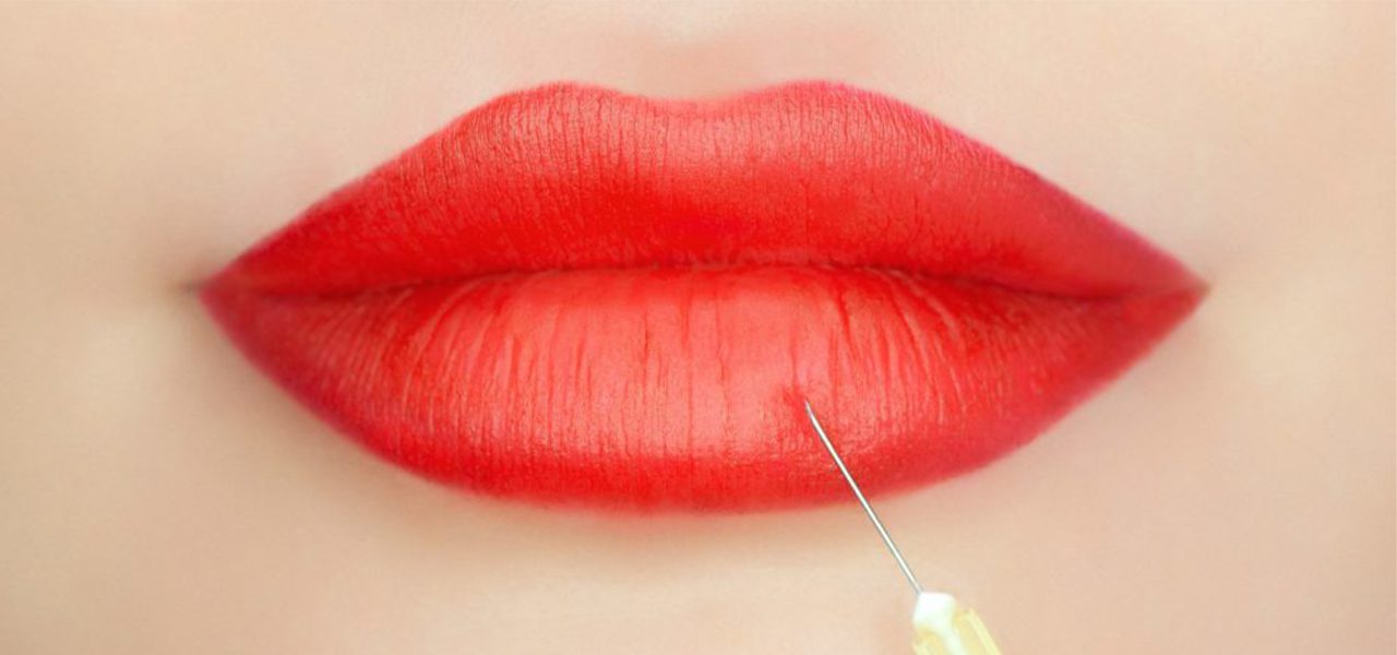 Lip Injections vs Implants Why Lip Injections Are Better