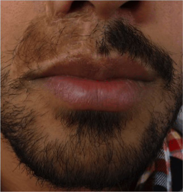 Beard Image 1 Beard Image 1