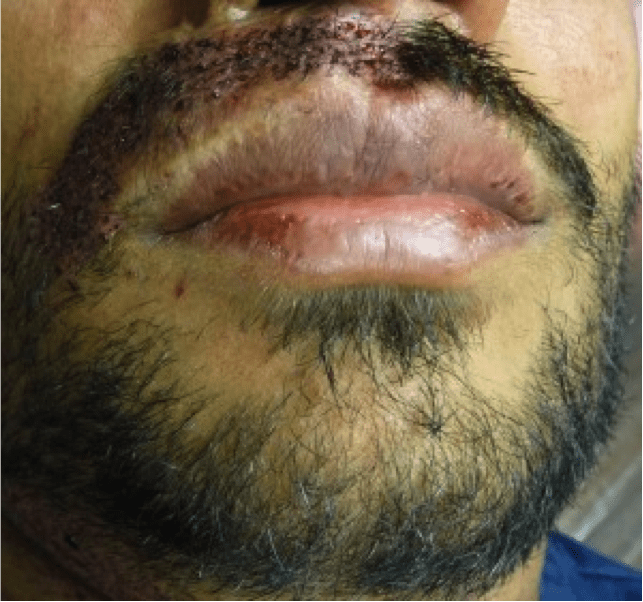 Beard Image 1