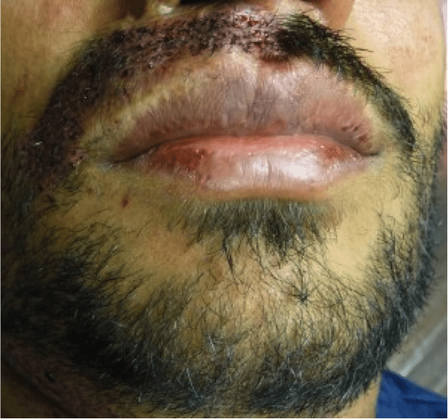 Beard Image 1 Beard Image 1