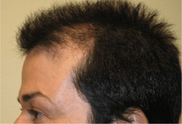 Hair Image 3 Hair Image 3