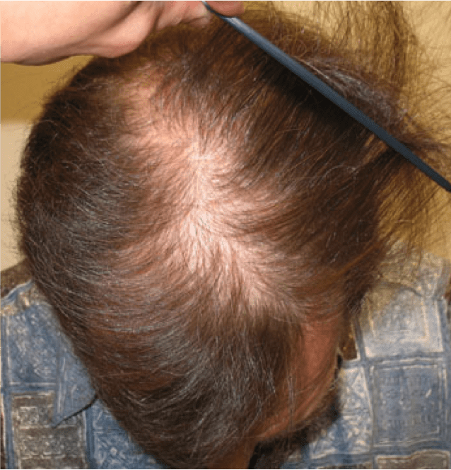 Hair Image 4 Hair Image 4