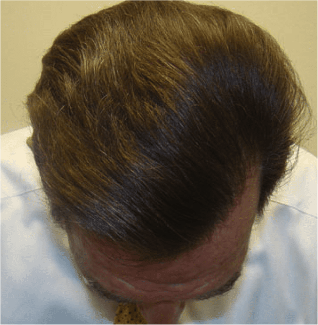 Hair Image 4 Hair Image 4