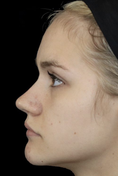 aesthetically pleasing to the eye and completing a lovely natural profile to a face.